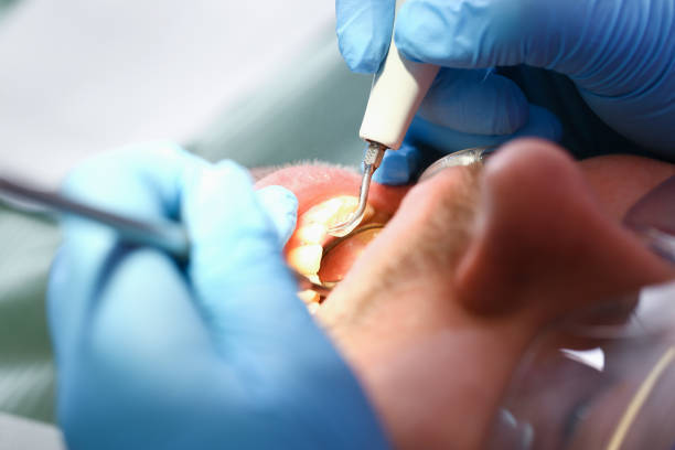 Best Emergency Denture Repair in Danbury, TX